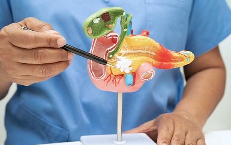 Avance en cáncer de páncreas: logran hacer más permeable la célula tumoral para mejorar la quimioterapia